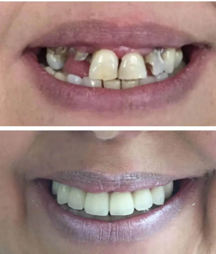 NÜVA SMILE