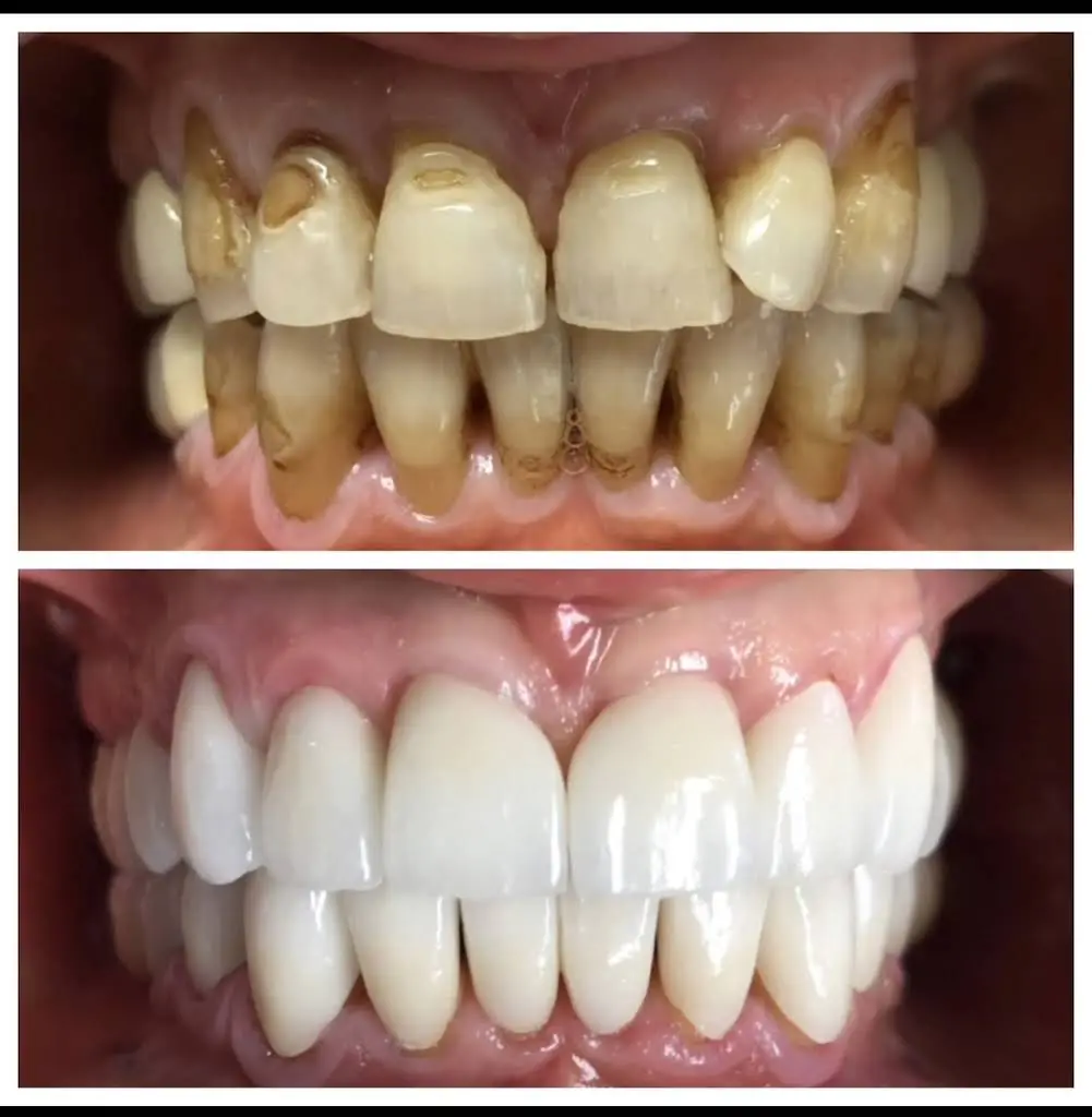 NÜVA SMILE