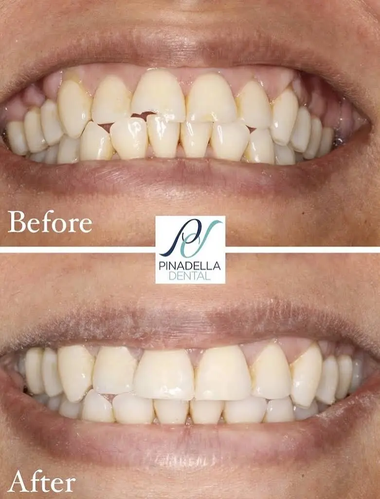 Pinadella Dental