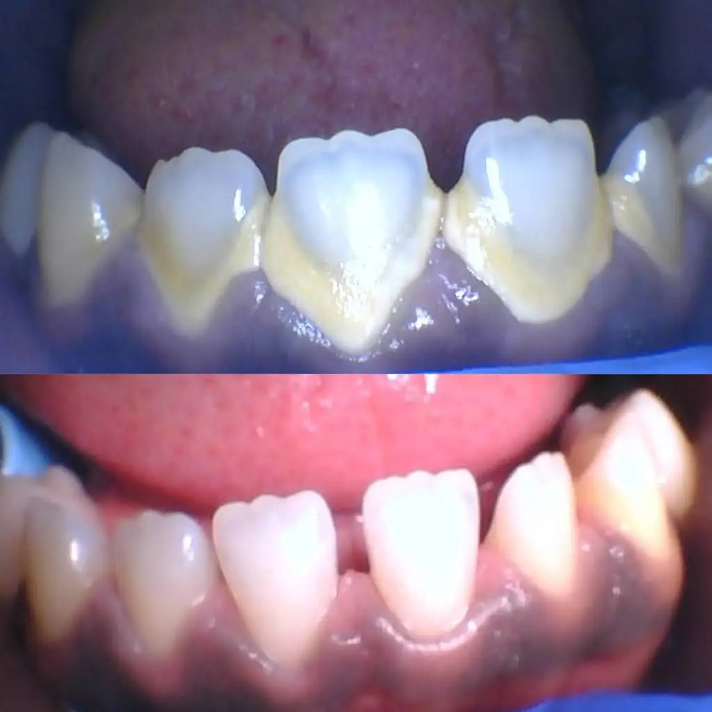Comfort Dental Care