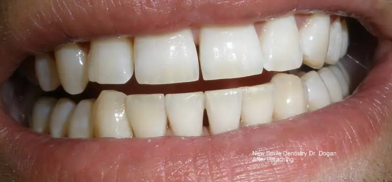 New Smile Dentistry