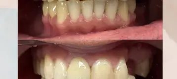 Simple Smiles Dentistry of Paterson