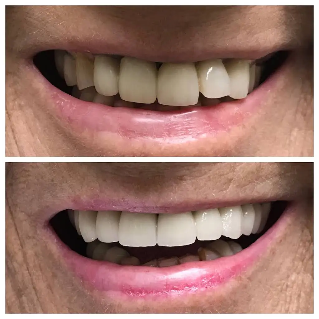 Simple Smiles Dentistry of Paterson