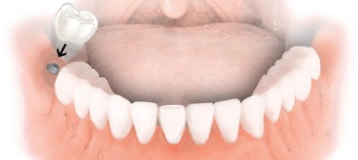 Integrated Dental Aesthetics