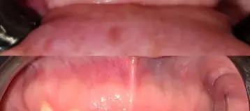 One Stop Dental
