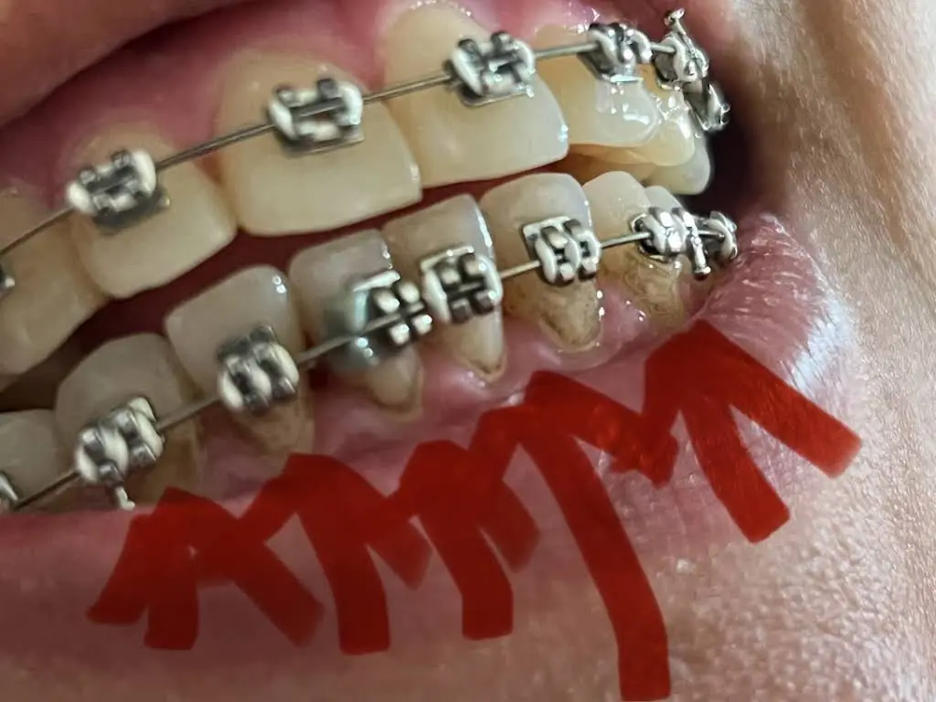 Queens Junction Dental
