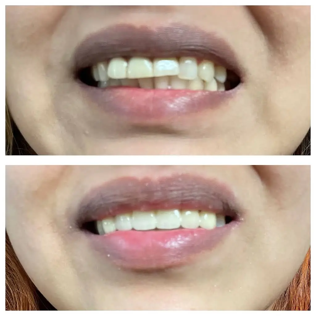 Elite Dental Rego Park