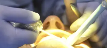 Achury Dental
