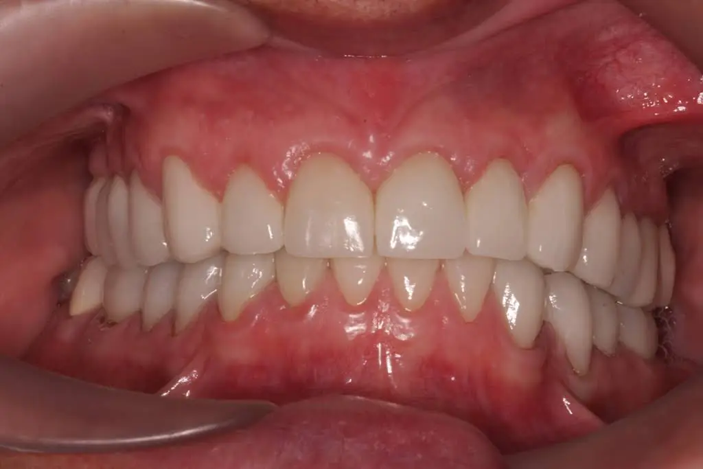 Better Living through Dentistry