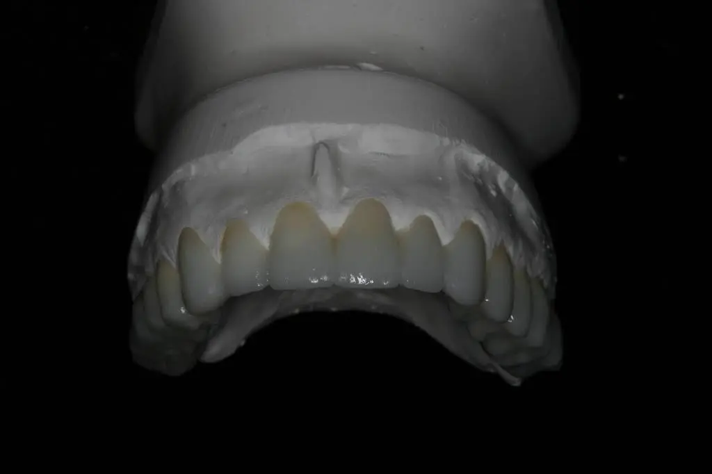 Better Living through Dentistry