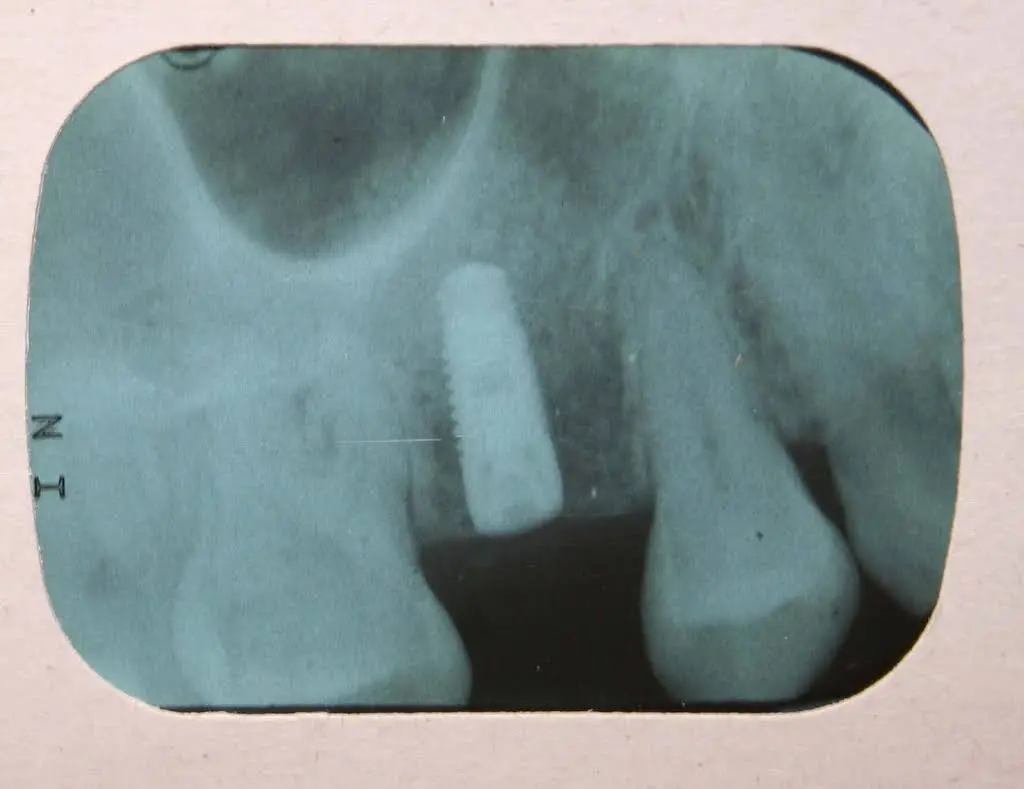 Better Living through Dentistry