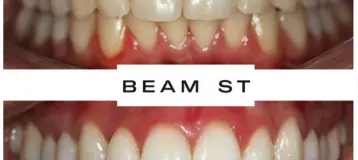 Beam Dental