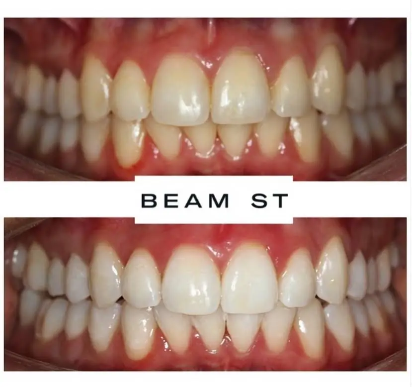 Beam Dental - Professional dental clinic exterior with modern facilities