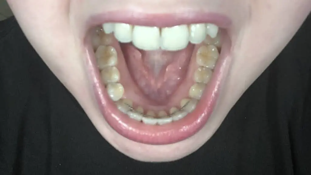 Beam Dental