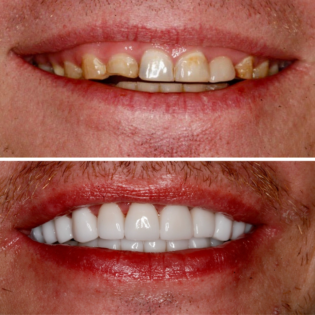 Dental Center West