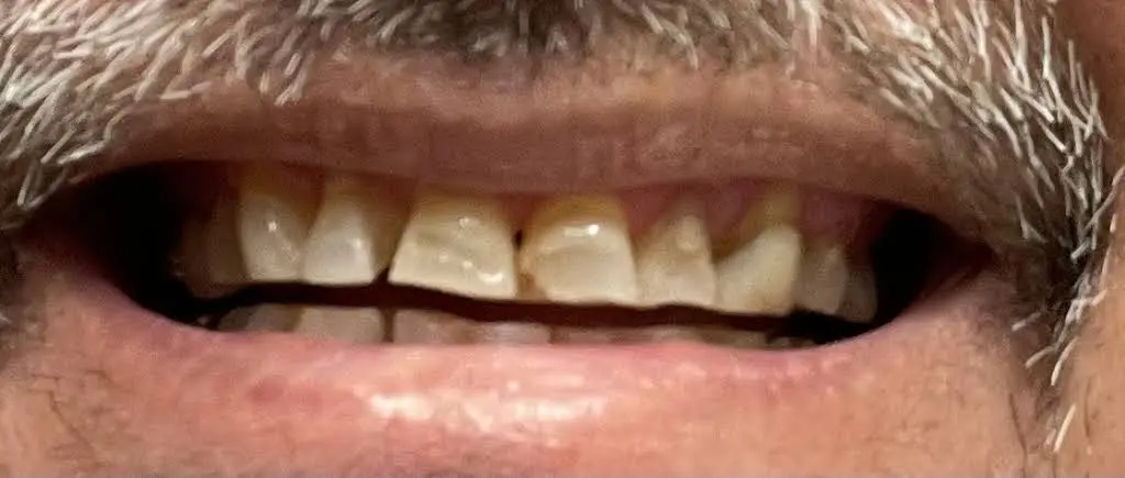 Dental Center West