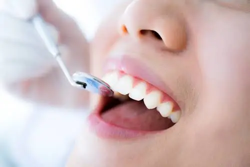 Trey Vereen, DMD - Family & Cosmetic Dentistry