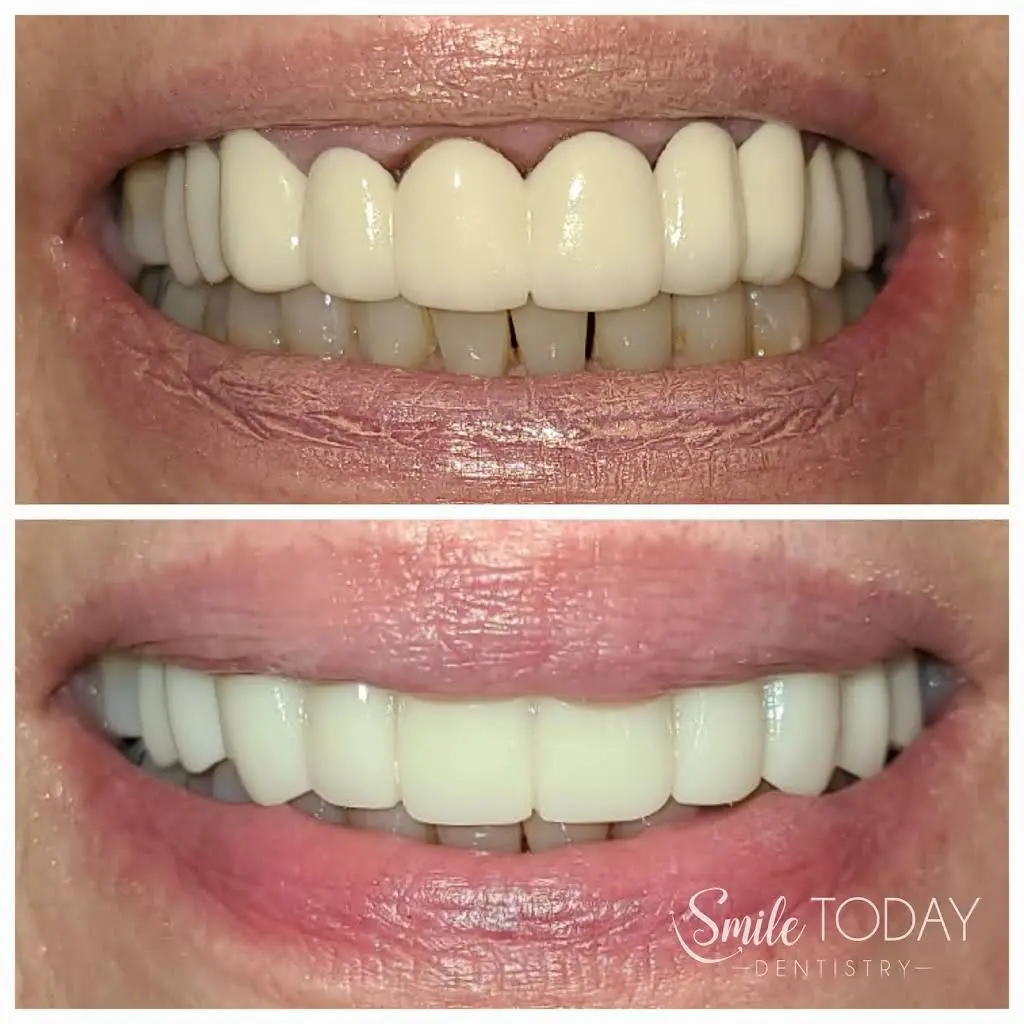 Smile Today Dentistry
