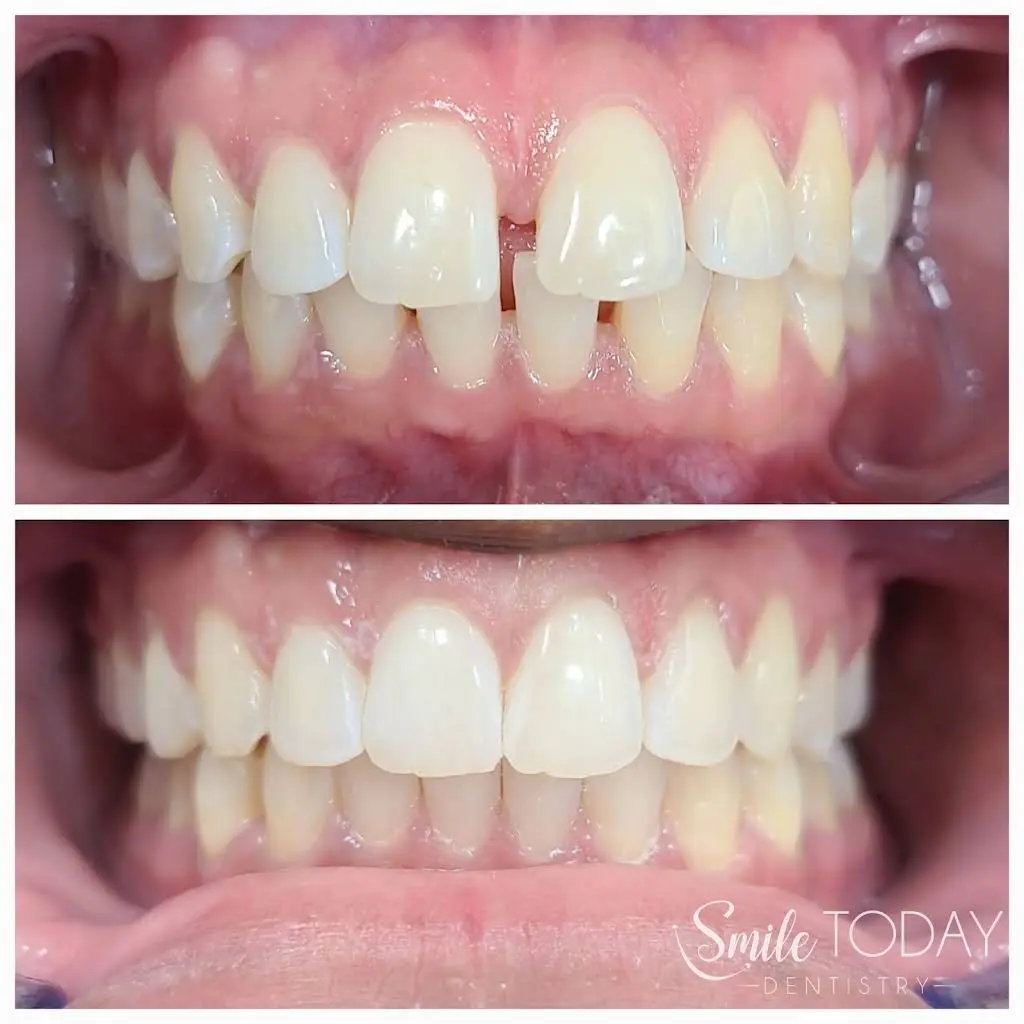 Smile Today Dentistry