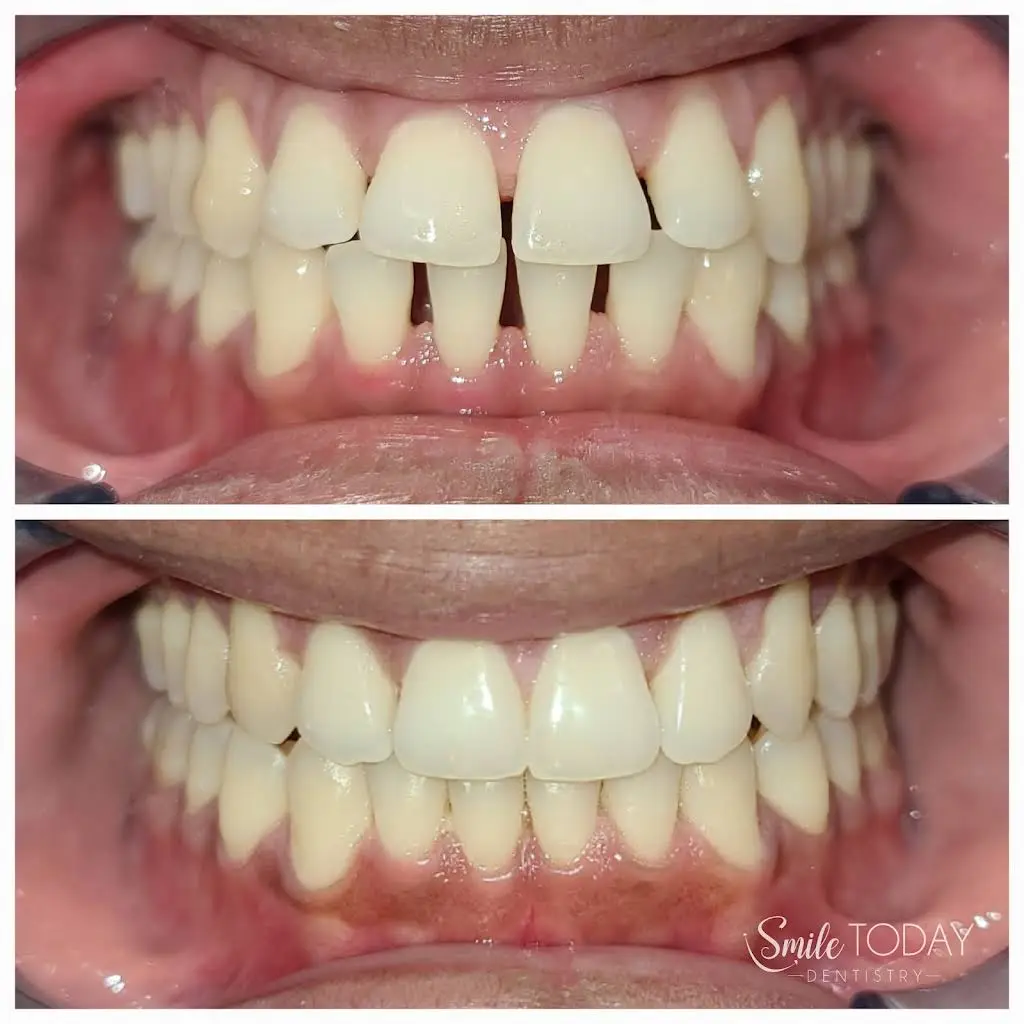 Smile Today Dentistry