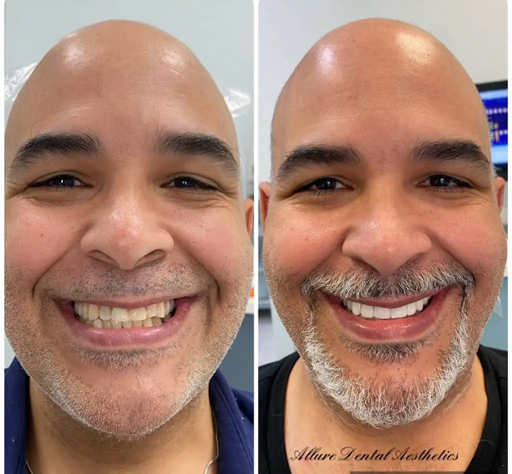 Allure Dental Care Family Dentistry