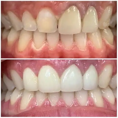 Dental Aesthetics | Dr. Sarah Mourad