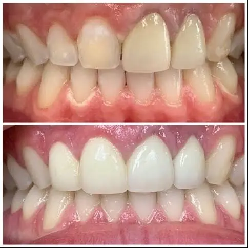 Dental Aesthetics | Dr. Sarah Mourad