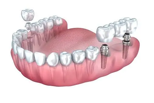Premier Periodontics Implant & Sedation Dentistry - Dr Jeffrey N. Zatzkin