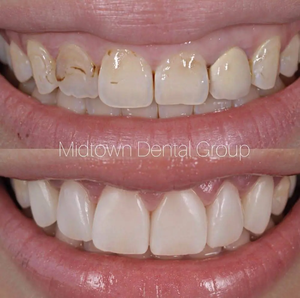 Midtown Dental Group Upper East Side