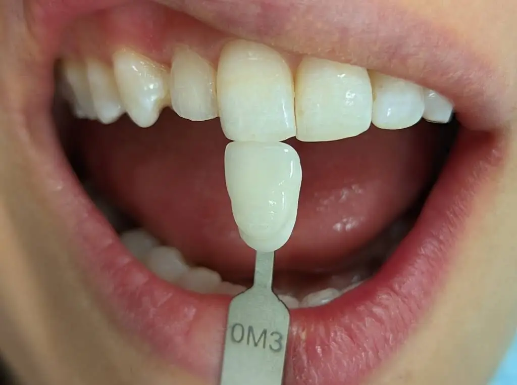 Luna Dental Astoria
