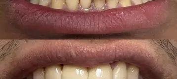 Austin Dental Care