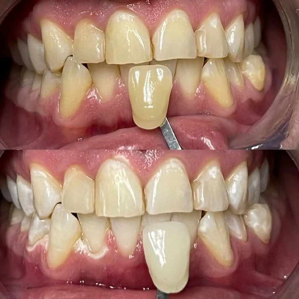 Austin Dental Care