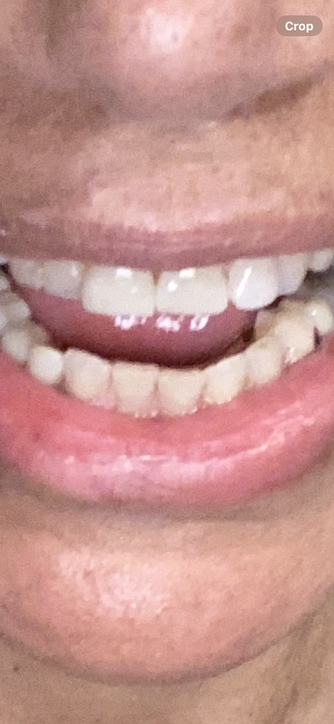 TCN Dental Care PC