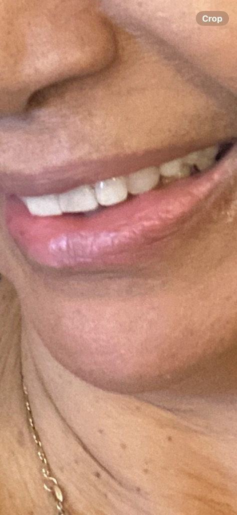TCN Dental Care PC