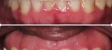 Better Living through Dentistry