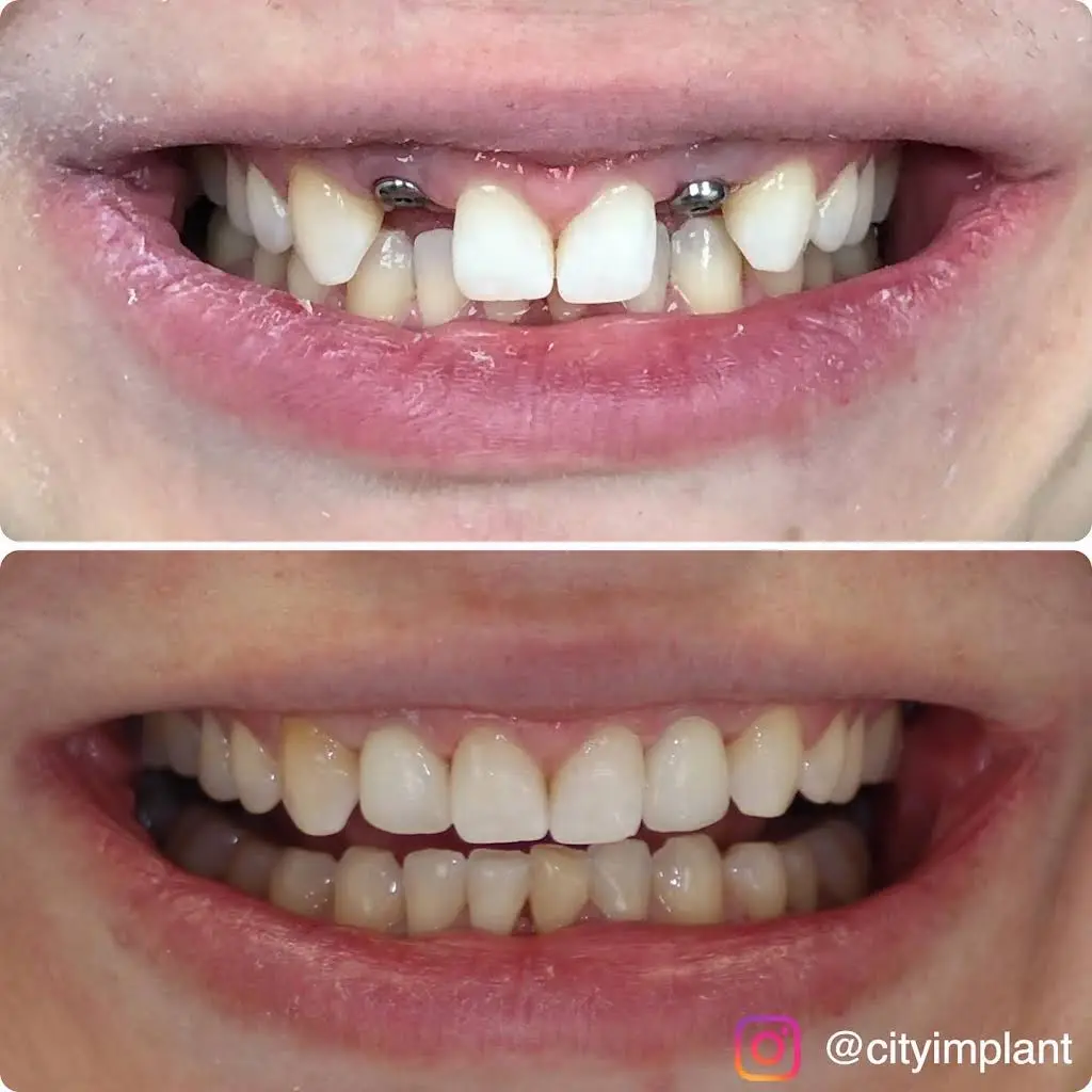 Better Living through Dentistry