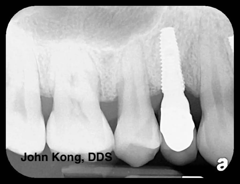 Better Living through Dentistry