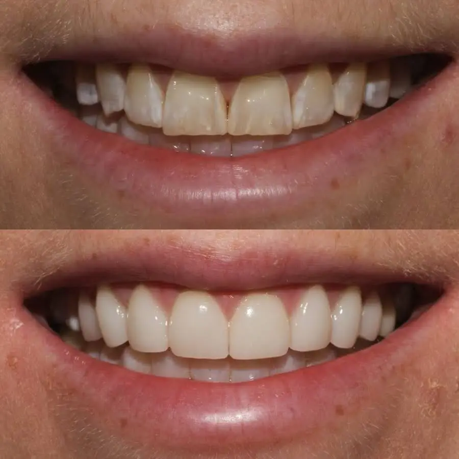 Lux Smiles NYC