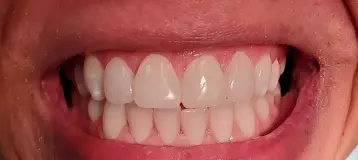 Wallington Dental