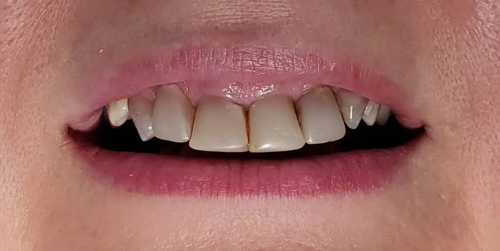 Wallington Dental