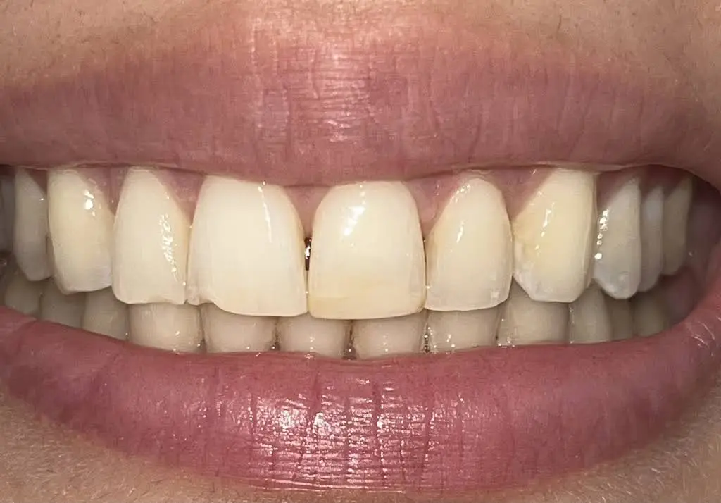 EverSmile Dental