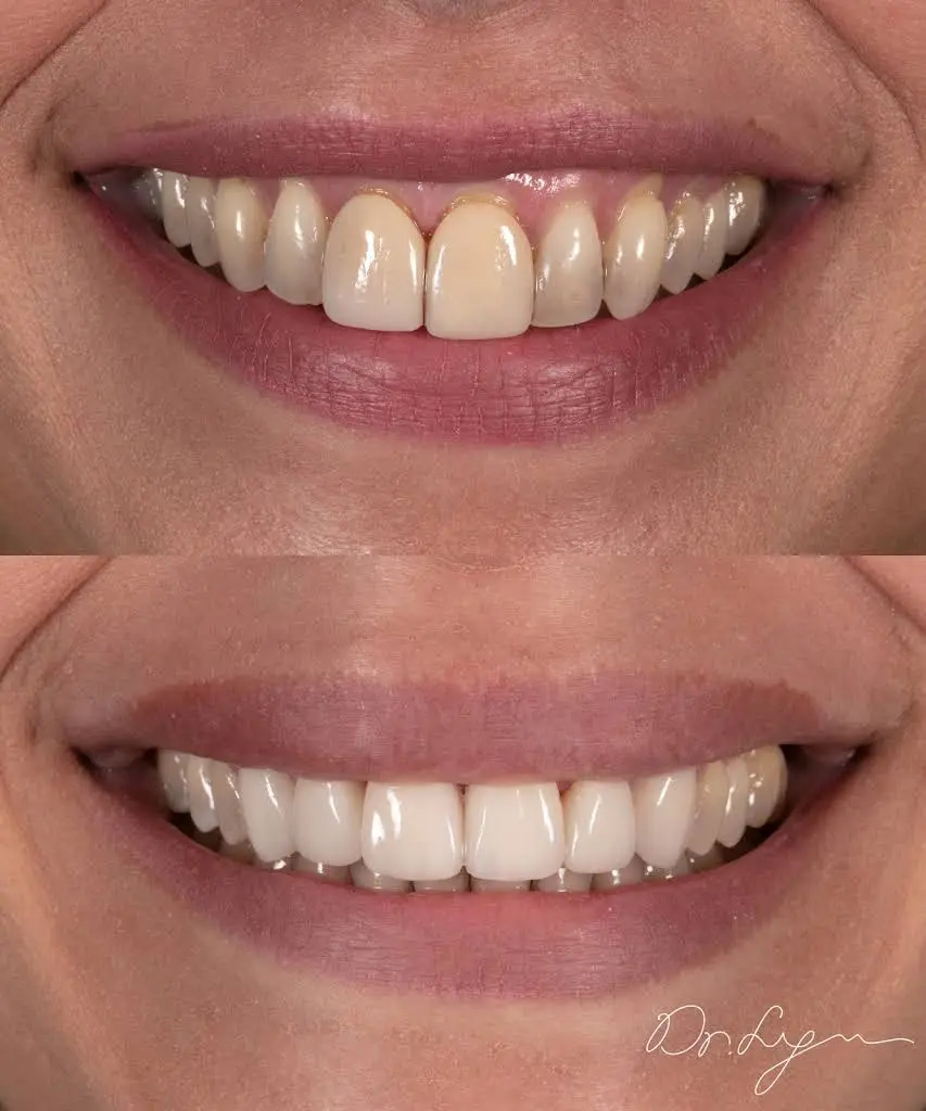 Ohana Dental of Bergen County