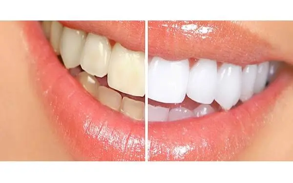 Ocean Dental