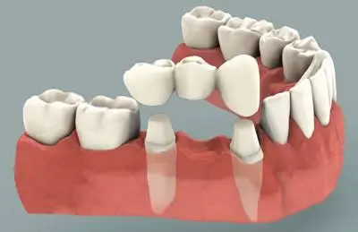 JCL Dental