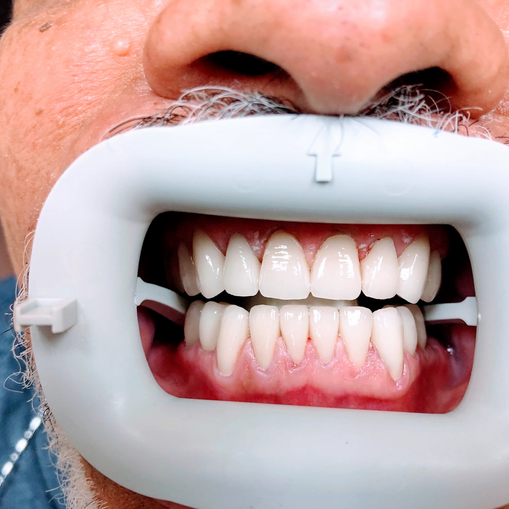 Queens Central Dental