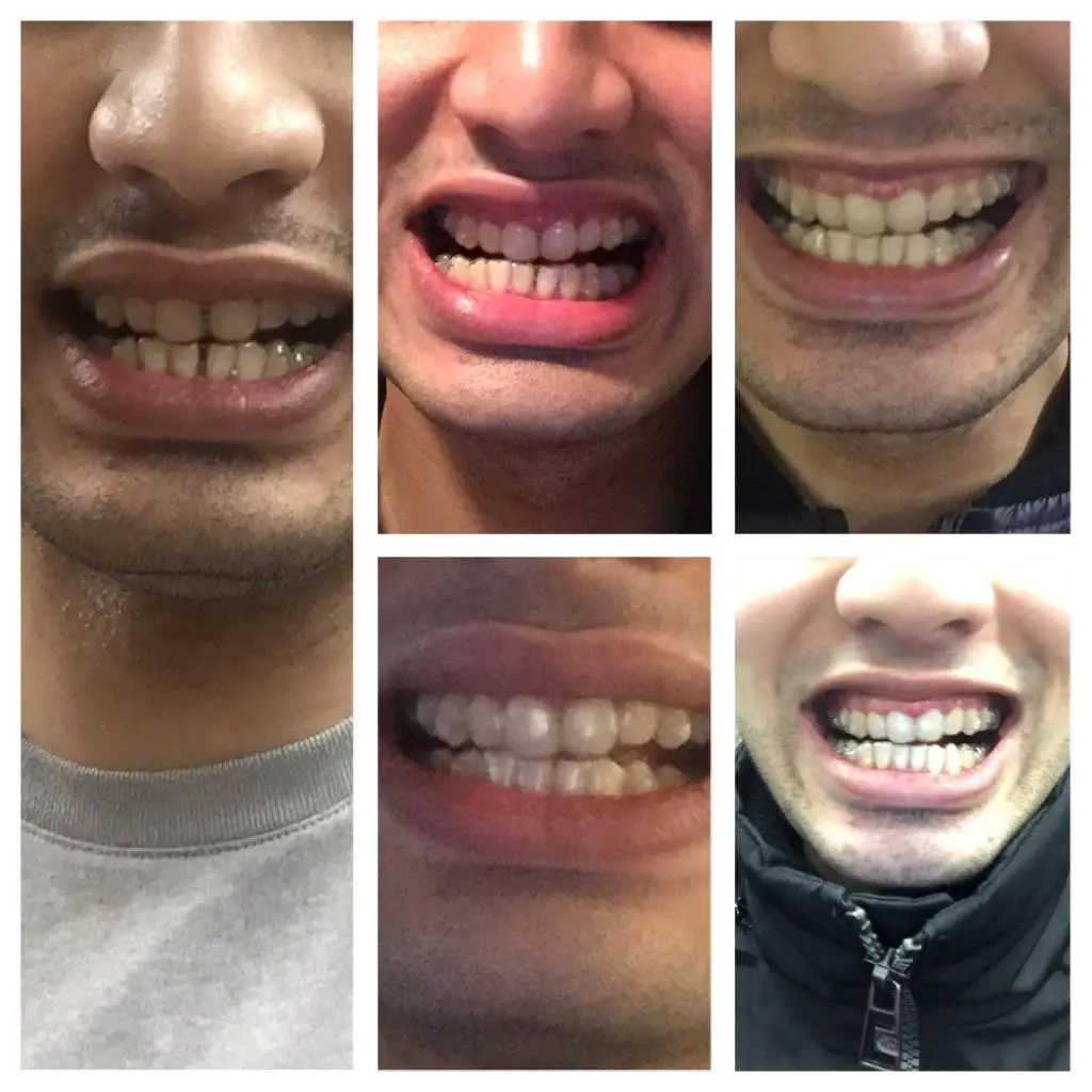 Amazing Smiles Orthodontics