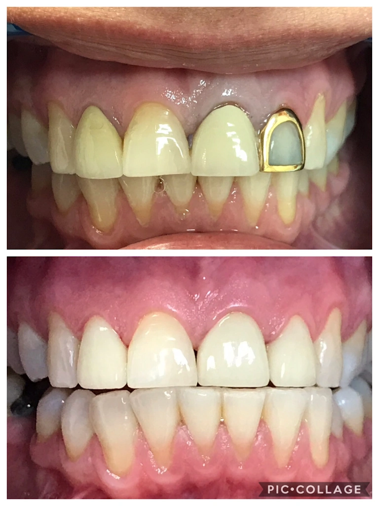 Queens Village Dental Associates