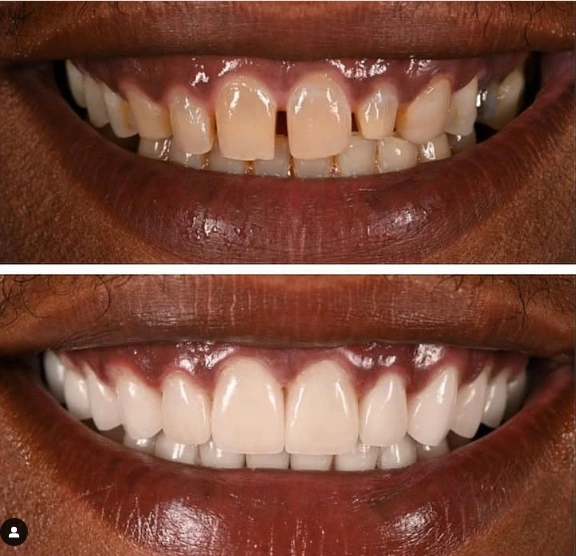 South Central Dental Implants