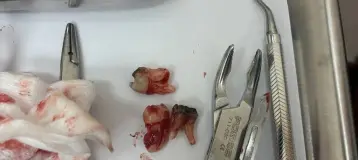 Dental Made Easy