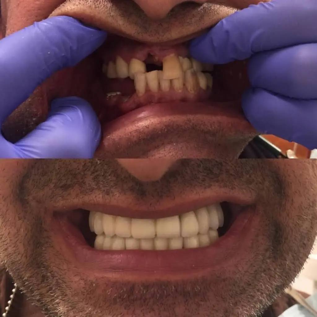 Perfect Teeth Dental PLLC